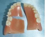 Reparatii proteze dentare
